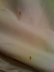 The spot of blood we found on a bed sheet at the Econo Lodge in West Yarmouth, Mass.
